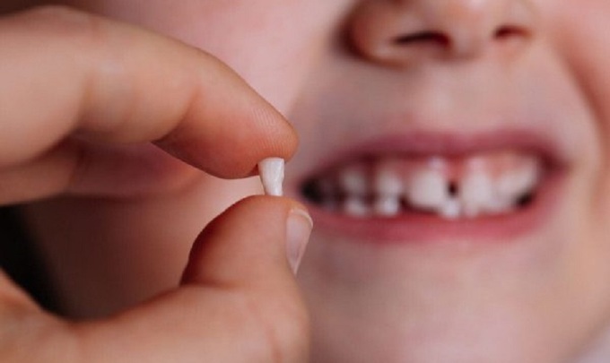 Trẻ bắt đầu thay răng ở độ tuổi nào, làm gì để tránh mọc lệch?
